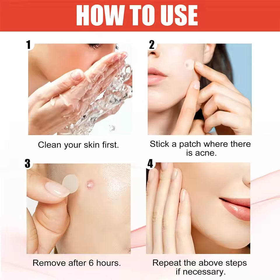 TALYO™ Derma Smooth Skin Patch – Instant Acne Or Skin Tag Treatment